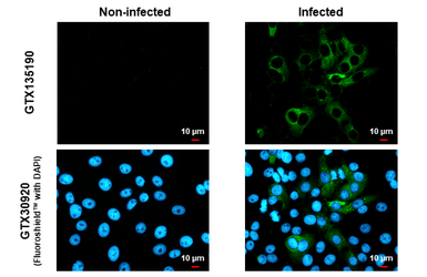 Anti-Chikungunya virus nsP4 antibody used in Immunocytochemistry/ Immunofluorescence (ICC/IF). GTX135190